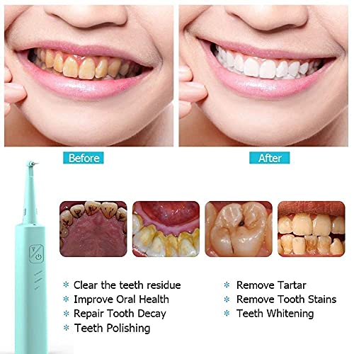 Dişler için Plak Sökücü, Elektrikli Ultrasonik Diş Temizleme Değnek, Plak ve Tartar Kaldırmak için Diş Araçları, 2 Kafa Temizleme